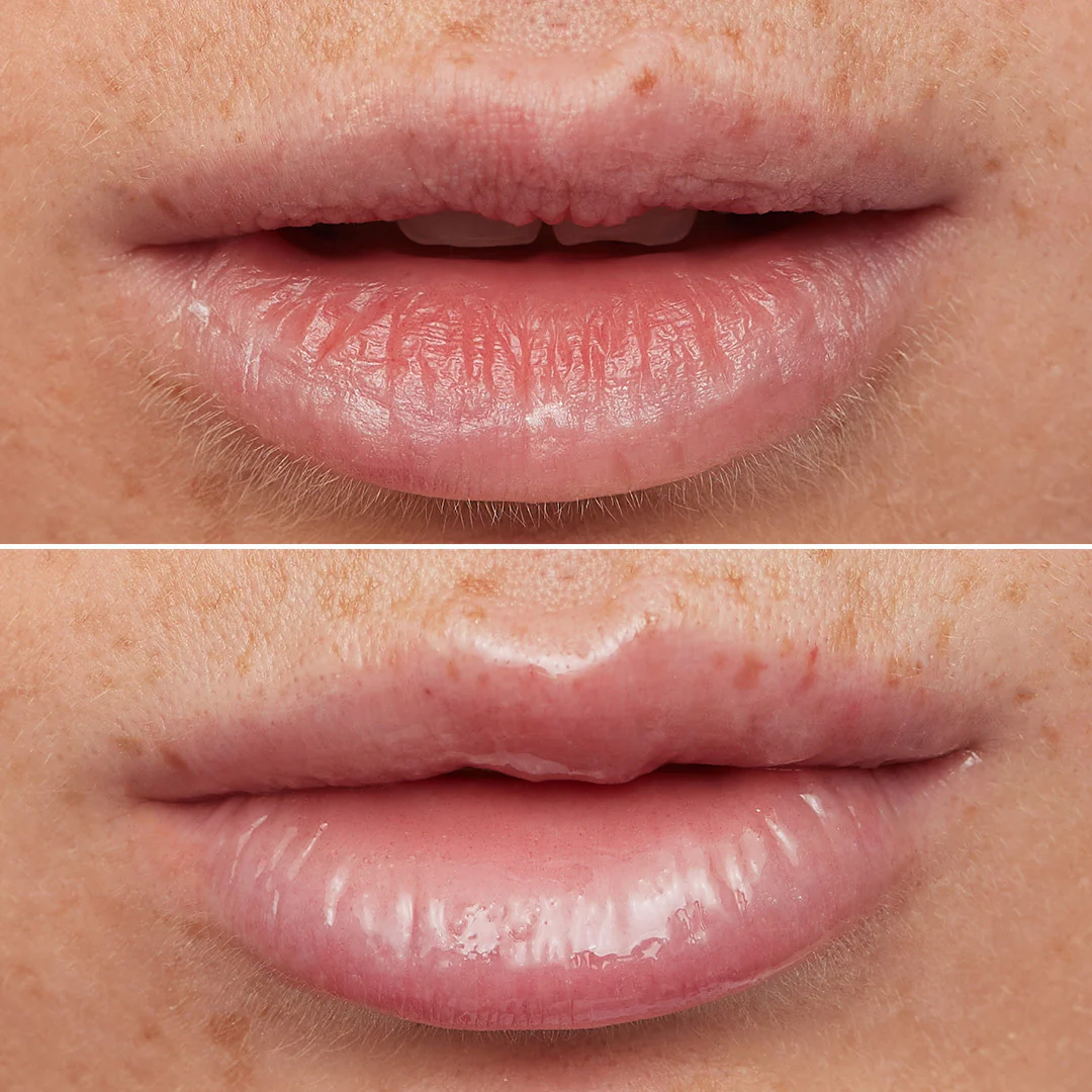 Lip Rehab Serum Oil - Image 5